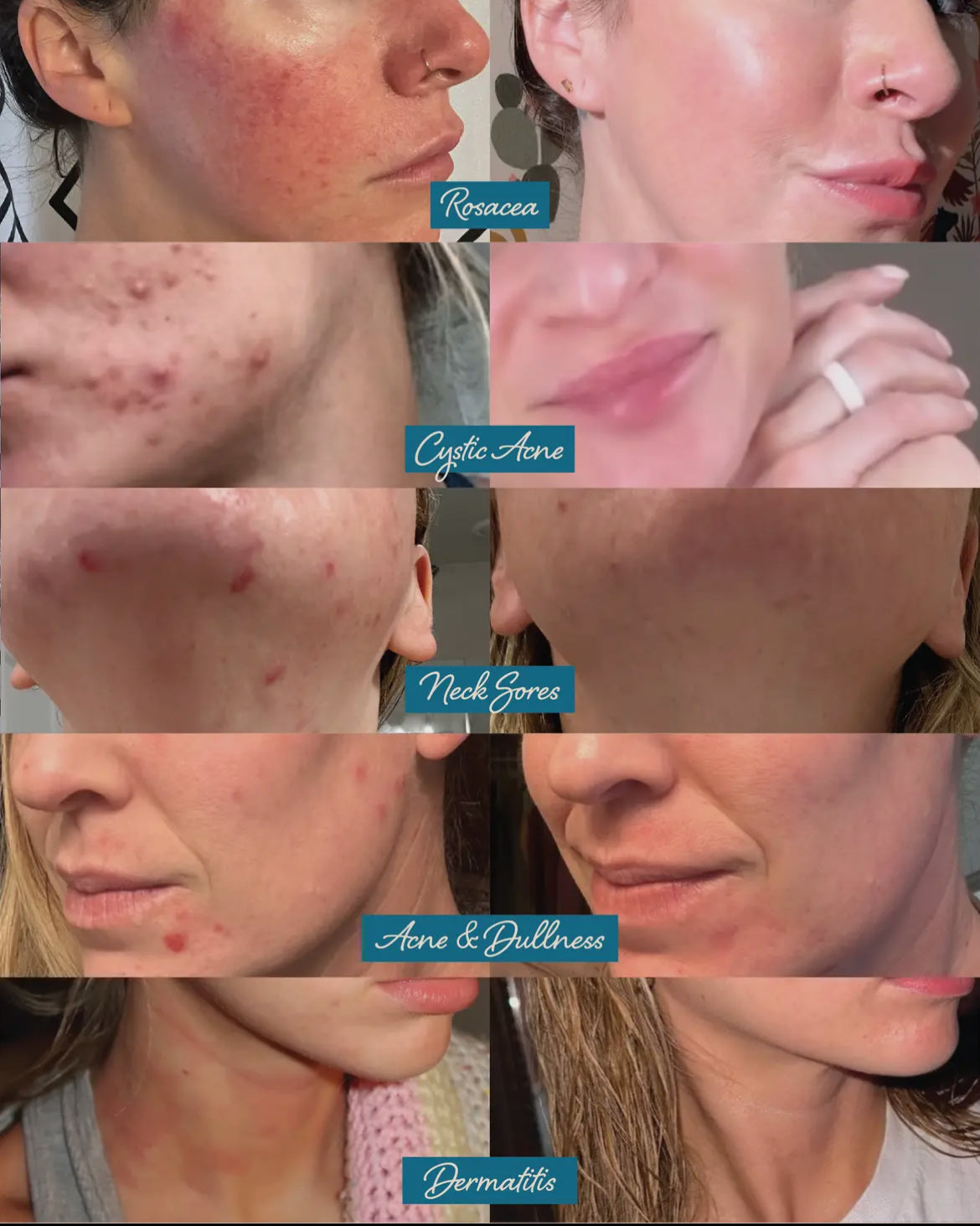 Darlin’ Skincare | Tallow Face Balm