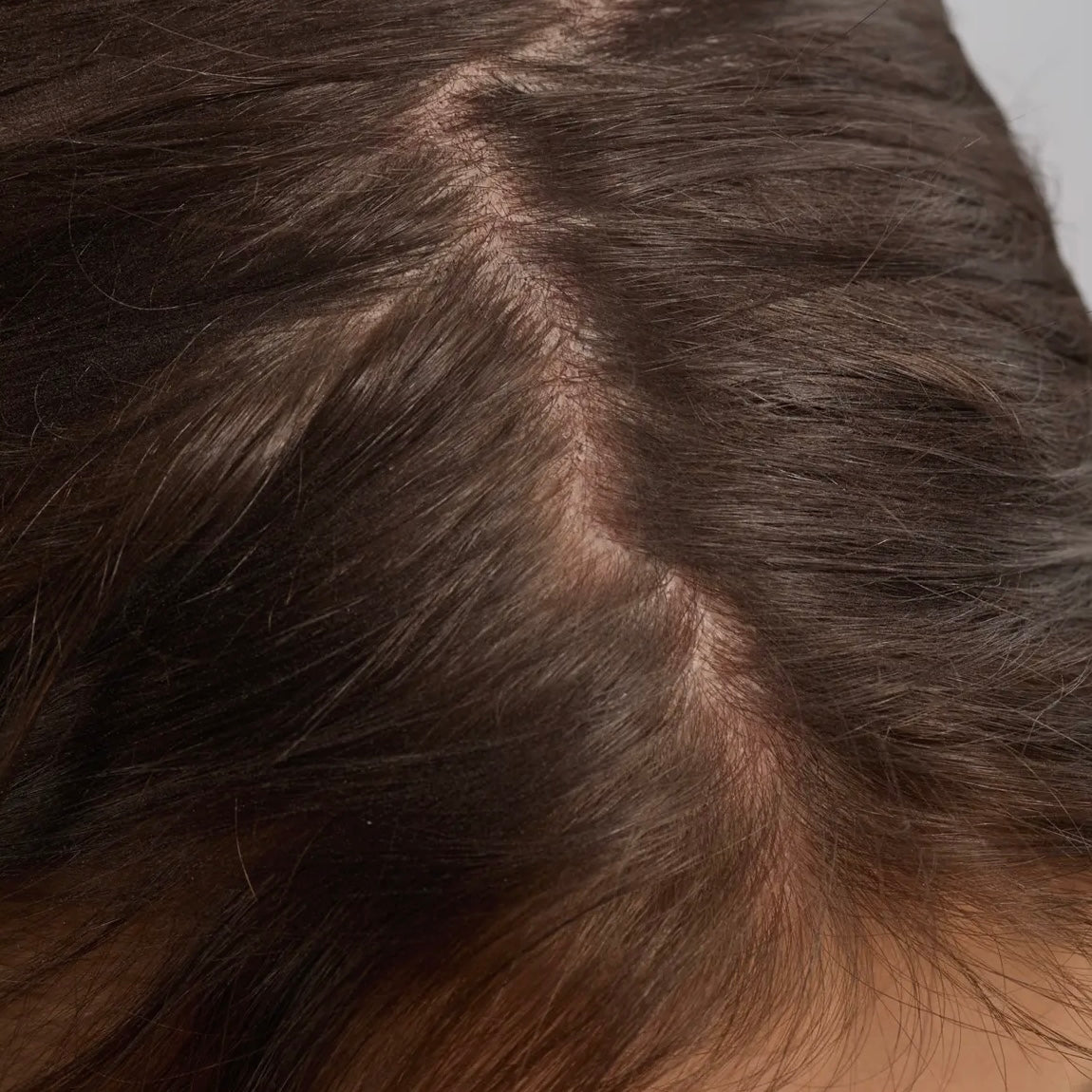 KITSCH | Strengthening Hair & Scalp Oil